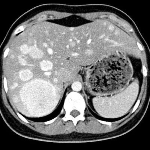 Der Radiologe ?️‍?